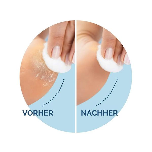 Scholl Site DE Care Scholl Velvet Smooth Nachfüller Wet&Dry - Extra Stark mit Diamantpartikeln